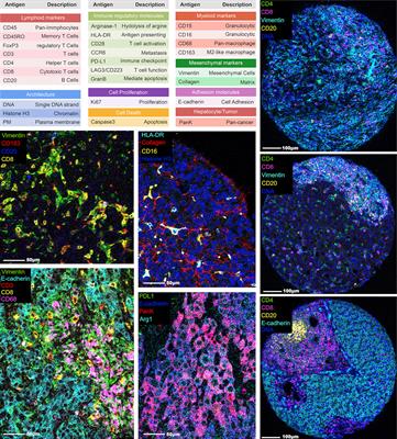 Multi-Scale Spatial Analysis of the Tumor Microenvironment Reveals Features of Cabozantinib and Nivolumab Efficacy in Hepatocellular Carcinoma